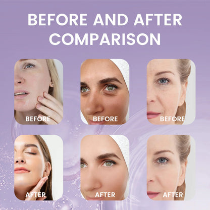 GlowKind™ Bakuchiol Renewal Serum - Gentle Power. Radiant Skin. Naturally.